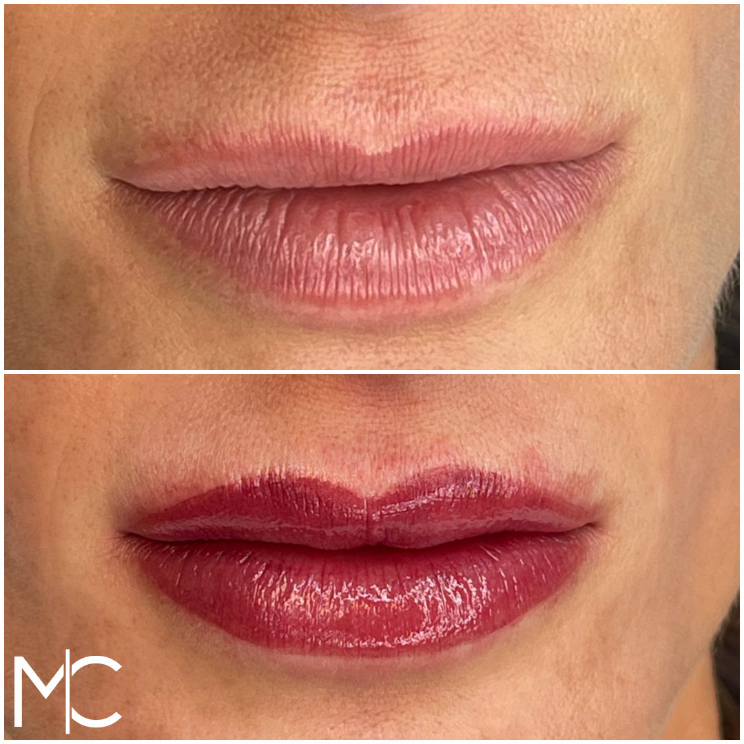 Lips