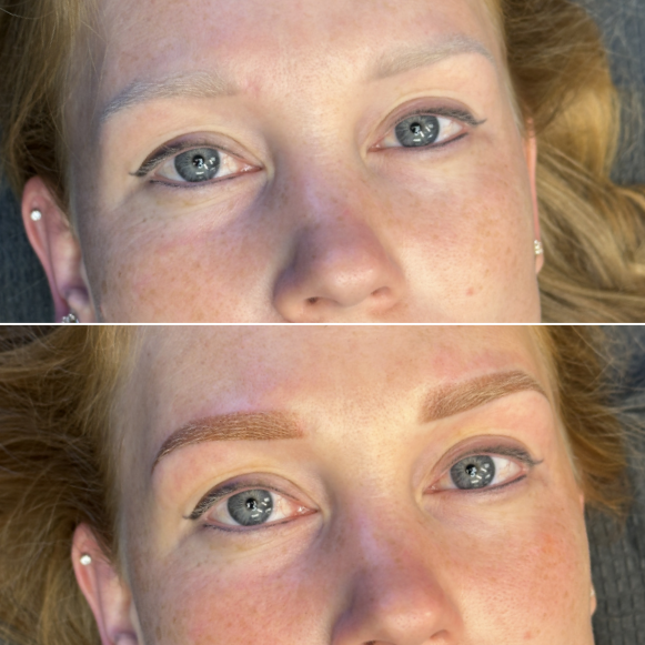 Gray Correction