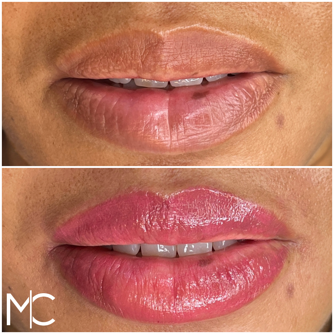 Lips