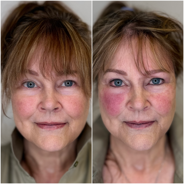 Top & Bottom Lash Lines by Jonny 
