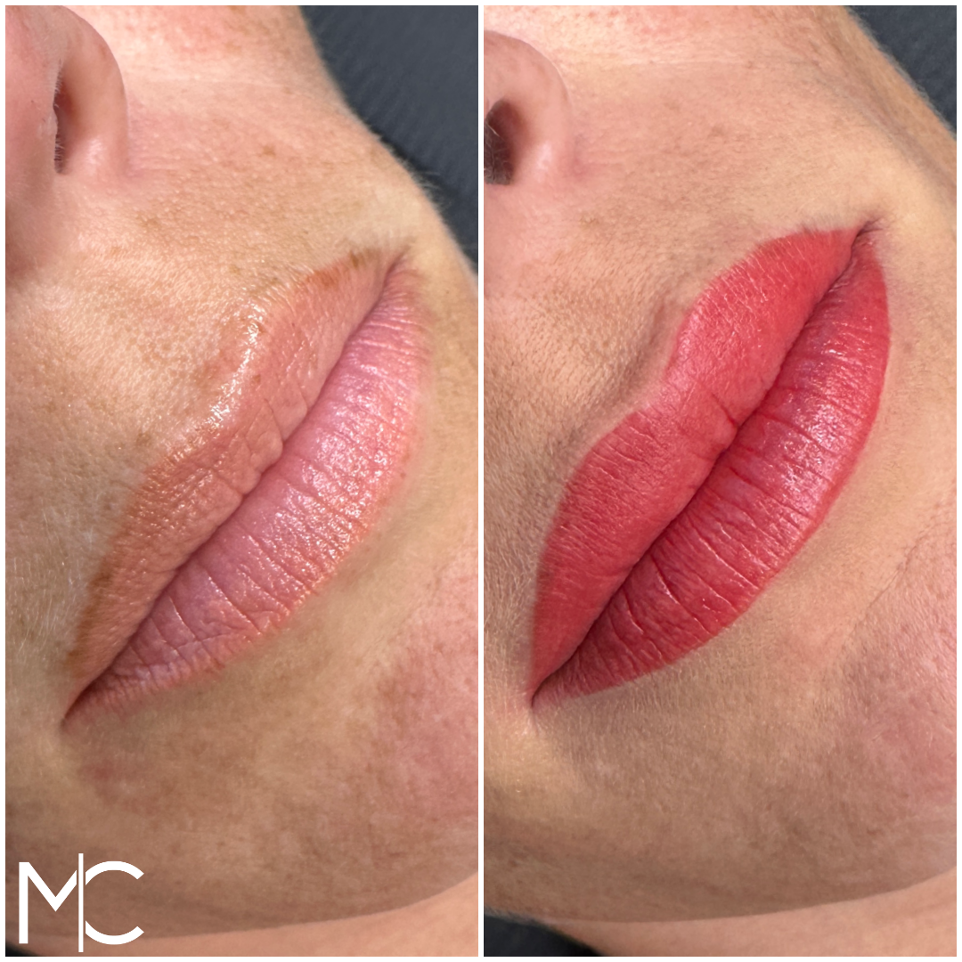 Lips