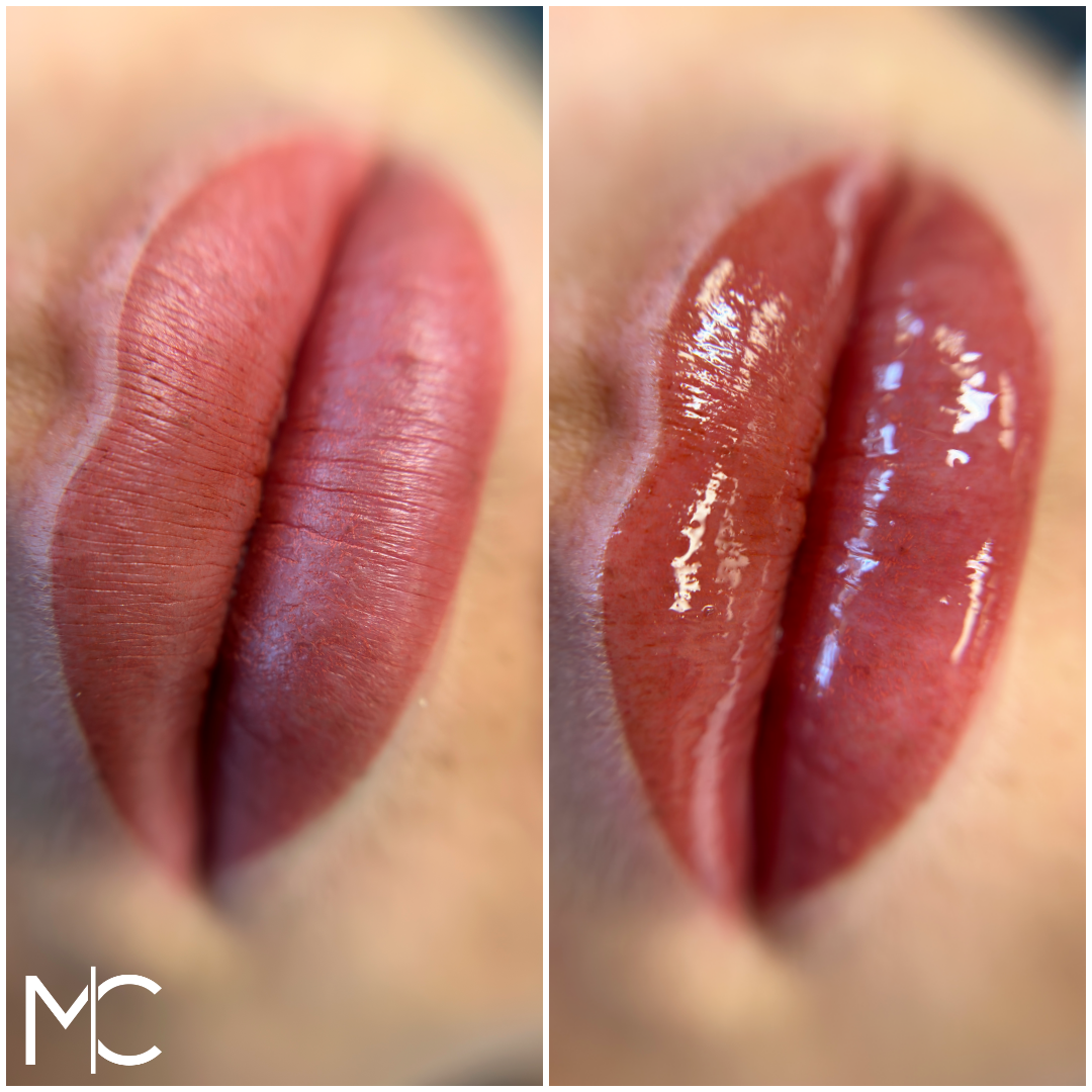 Lips