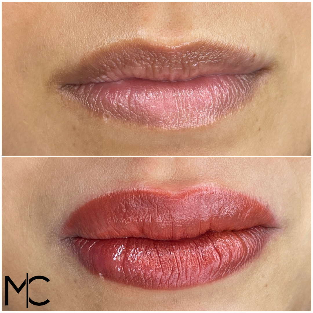Lips