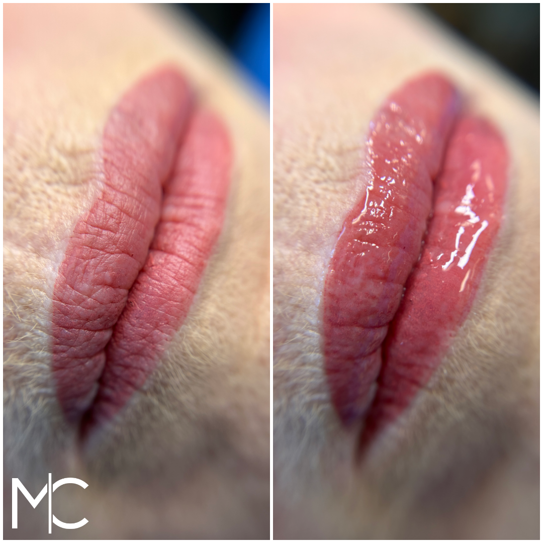 Lips