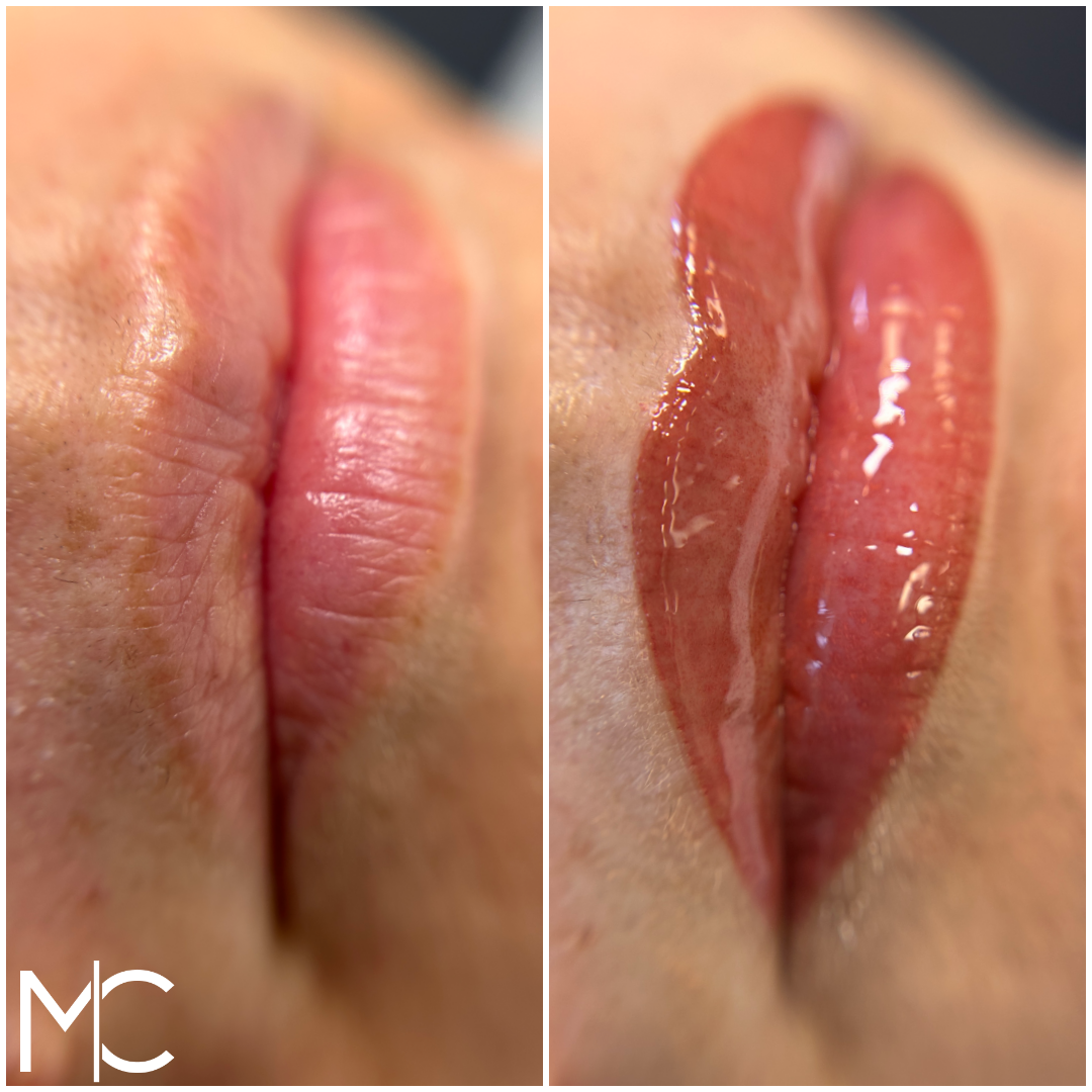Lips