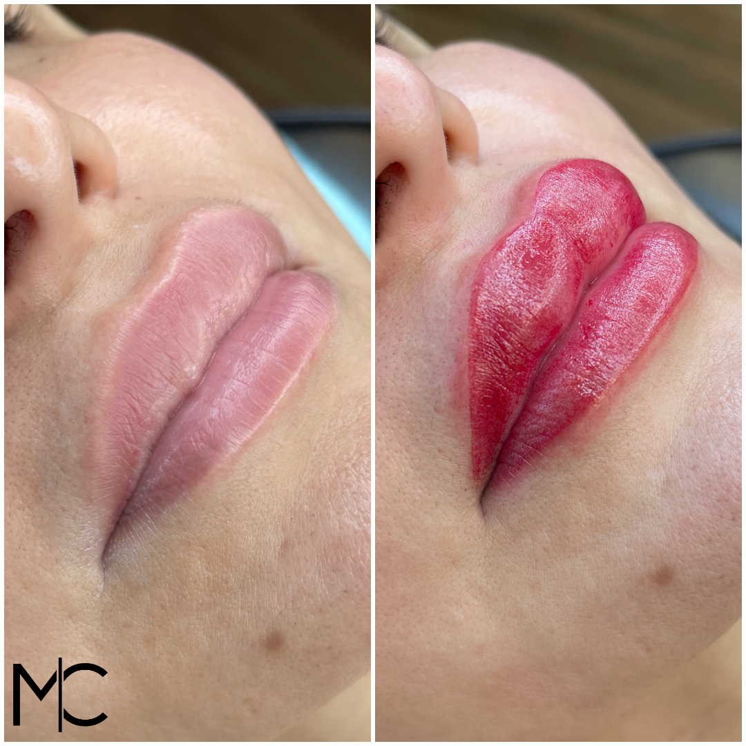 Lips