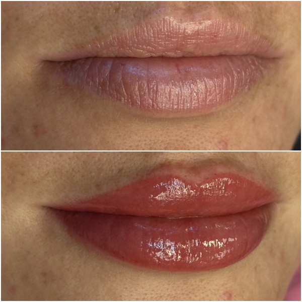 Fair Lips 