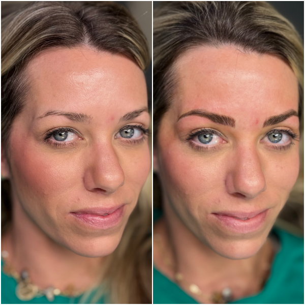 Brow mailer 5.png