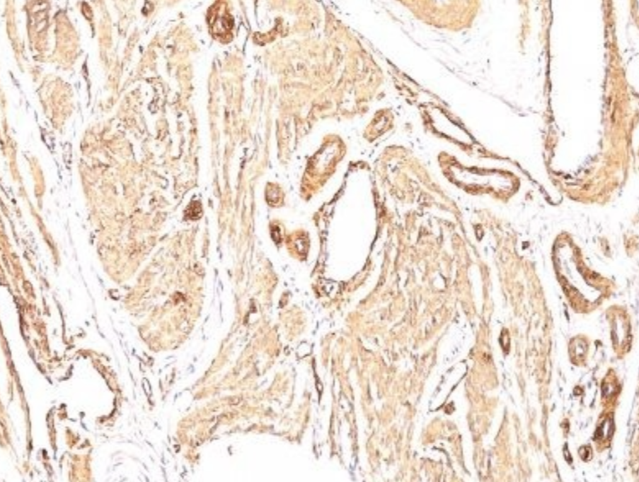 Microscopic image of tissue sample showing stained cells and structures.