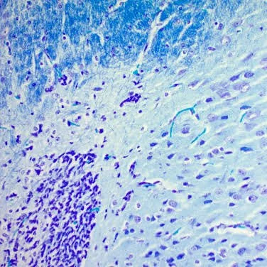 Advanced Histology &amp; IHC: Expanding Our Custom Target Staining Panels