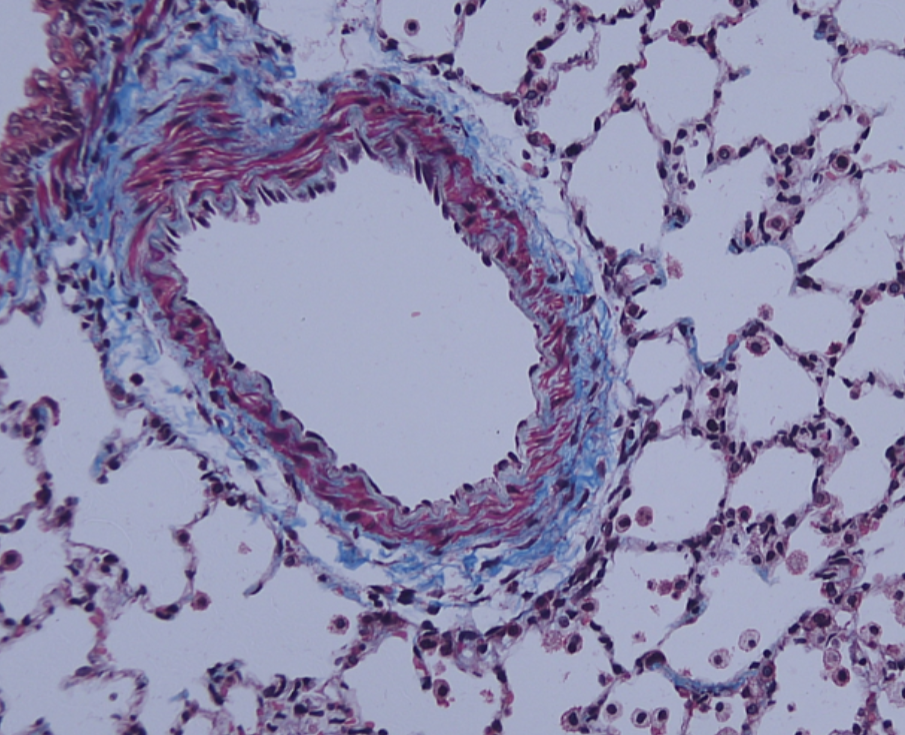 A microscopic view of a blood vessel within lung tissue, showcasing alveoli surrounding the vessel, stained to highlight cellular structures.