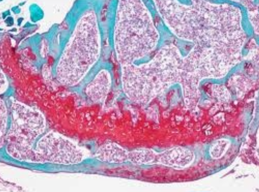 Microscopic view of tissue with pink and purple cells and blue connective tissue.