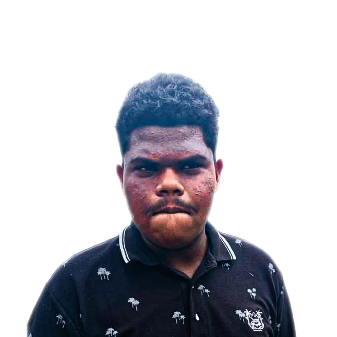 A young man with acne and dark hair, wearing a black shirt with white palm tree patterns, stands against a plain white background.