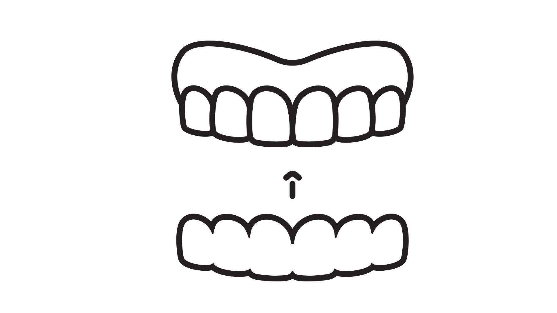 Diagramm zeigt den Prozess des Zähneputzens. Oben ein offenstehender Mund mit Zähnen, in der Mitte ein Pfeil nach oben, der die Reinigungsbewegung anzeigt, und unten eine geschlossene Zahnreihe.