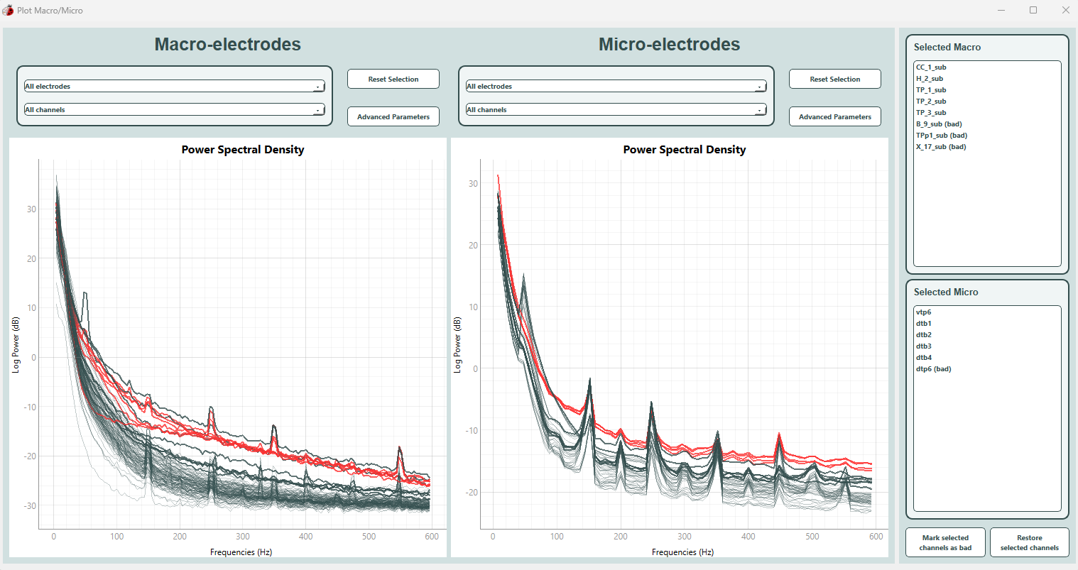 Screenshot of the preprocessing feature