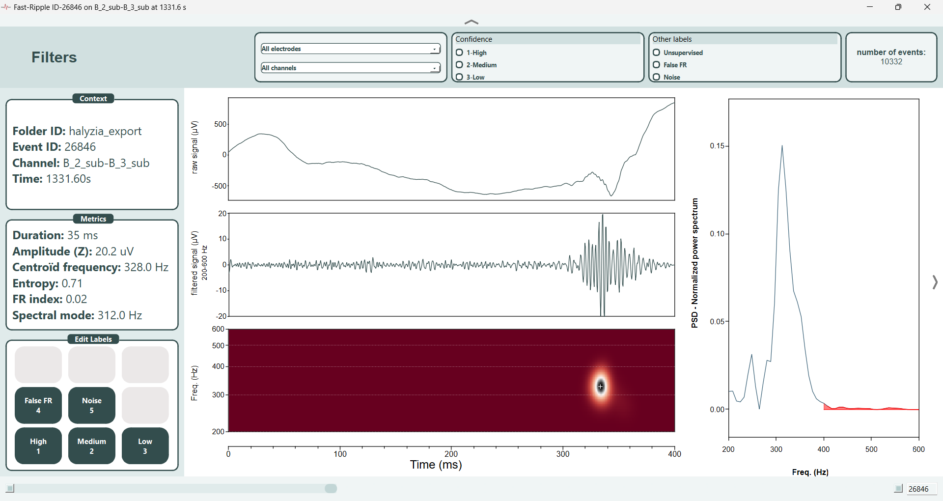 Screenshot of the individual ripples and fast ripples detector feature