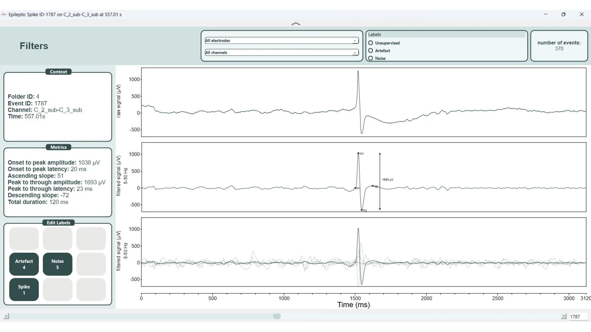 Screenshot of the individual epileptic spikes viewer