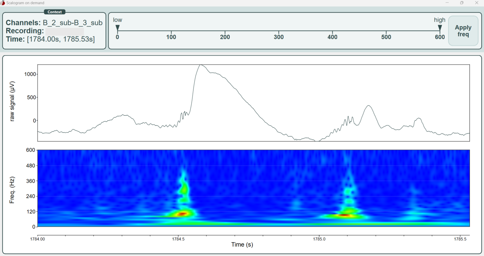 Screenshot of the scalogram on demand feature
