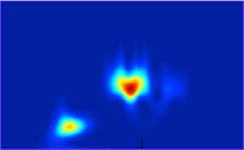 Picture of a scalogram with a heart shape