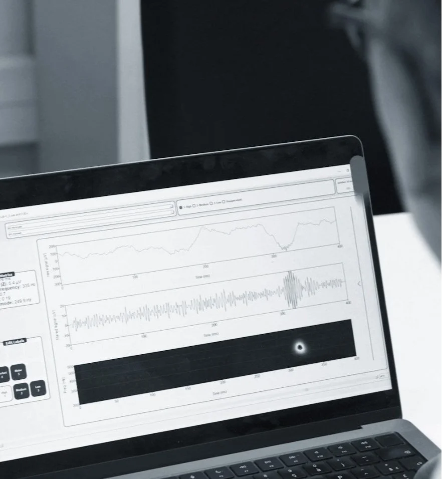 A picture of the interface of Halyzia