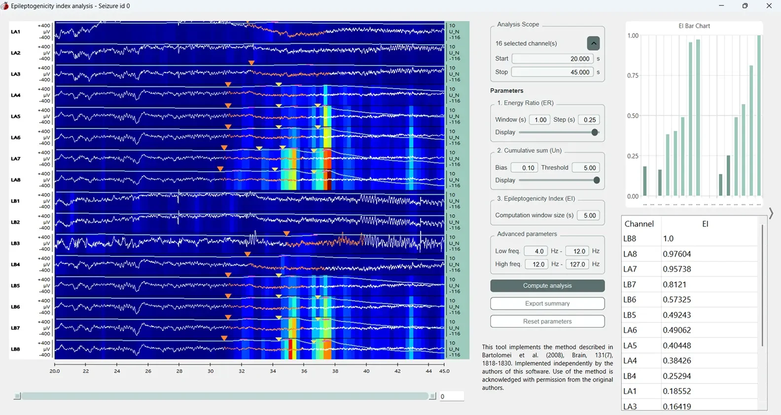 Screenshot of the epileptogenicity index