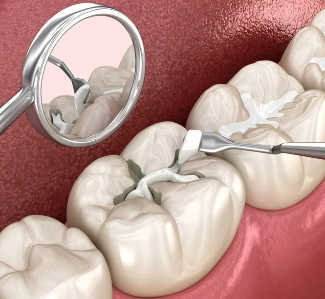 Close-up illustration of dental procedure with molar teeth, a dental mirror, and dental scaler cleaning the teeth.