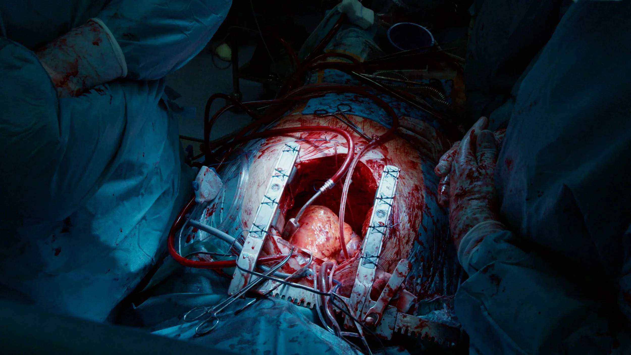 P26405_Hartslagvaneenander_Still05_1