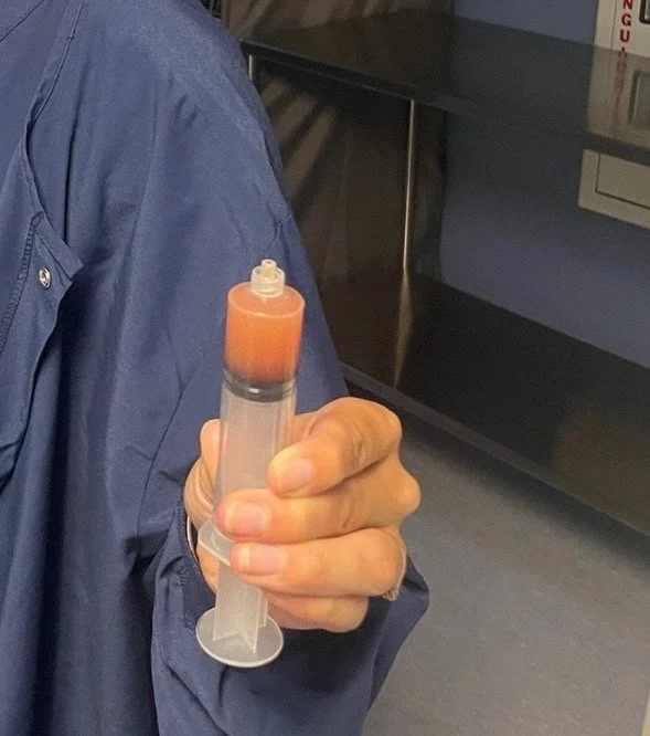 PRP 3 - Revolutionary Foot + Ankle Specialists.jpeg