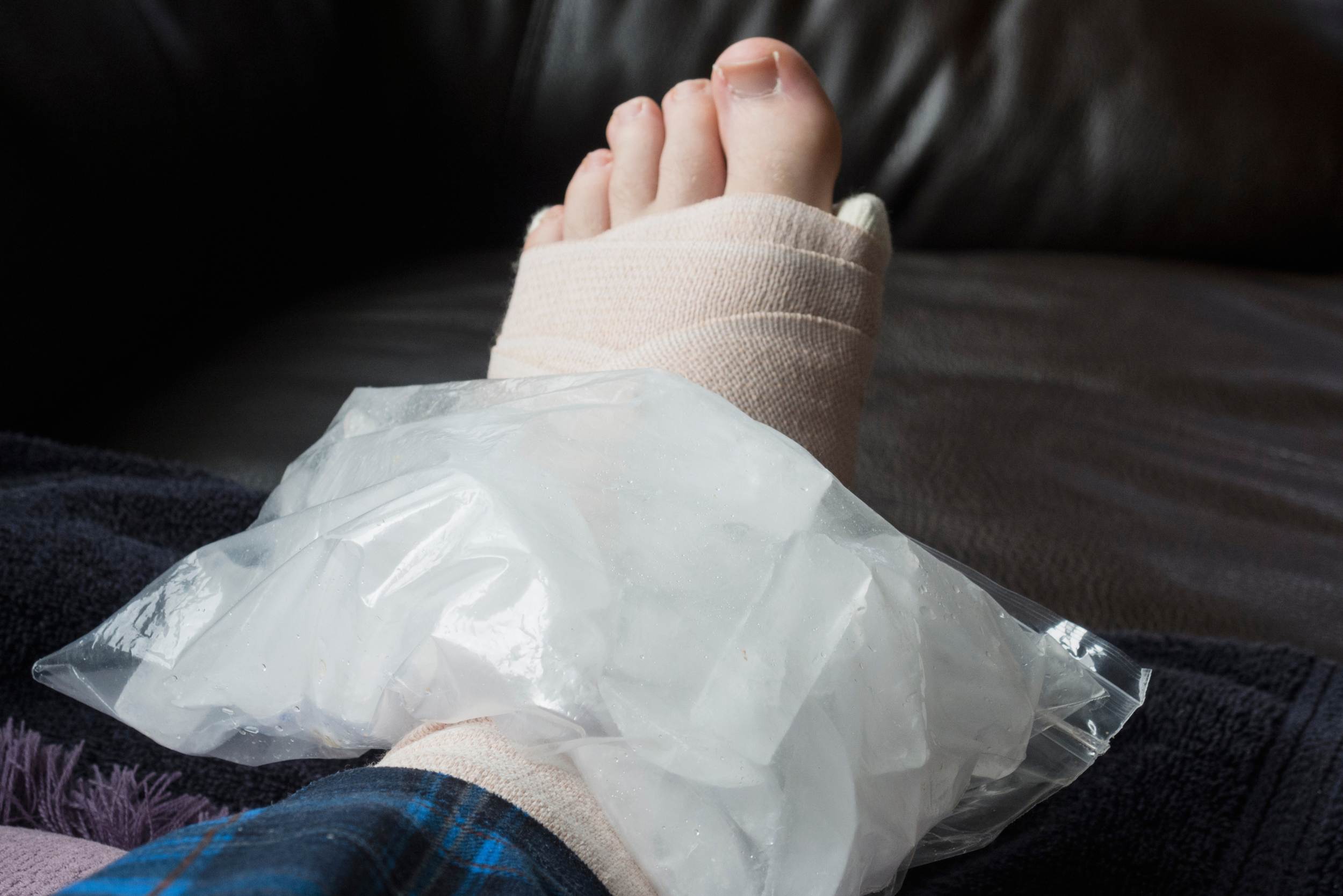 RICE method for foot and ankle recovery