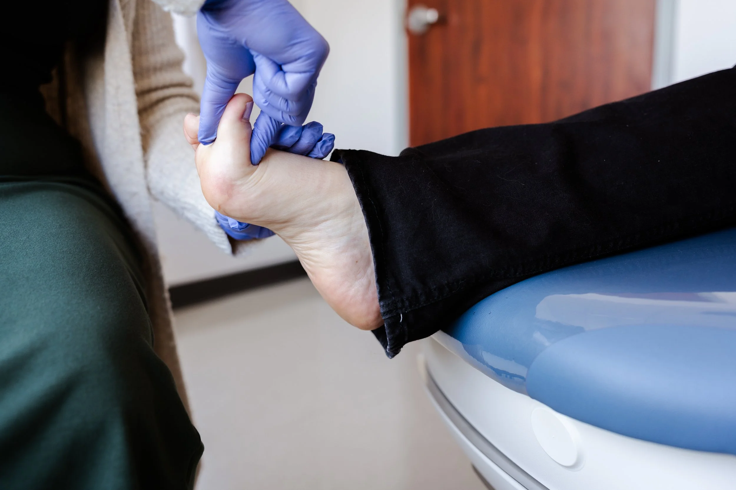 bunion treatment
