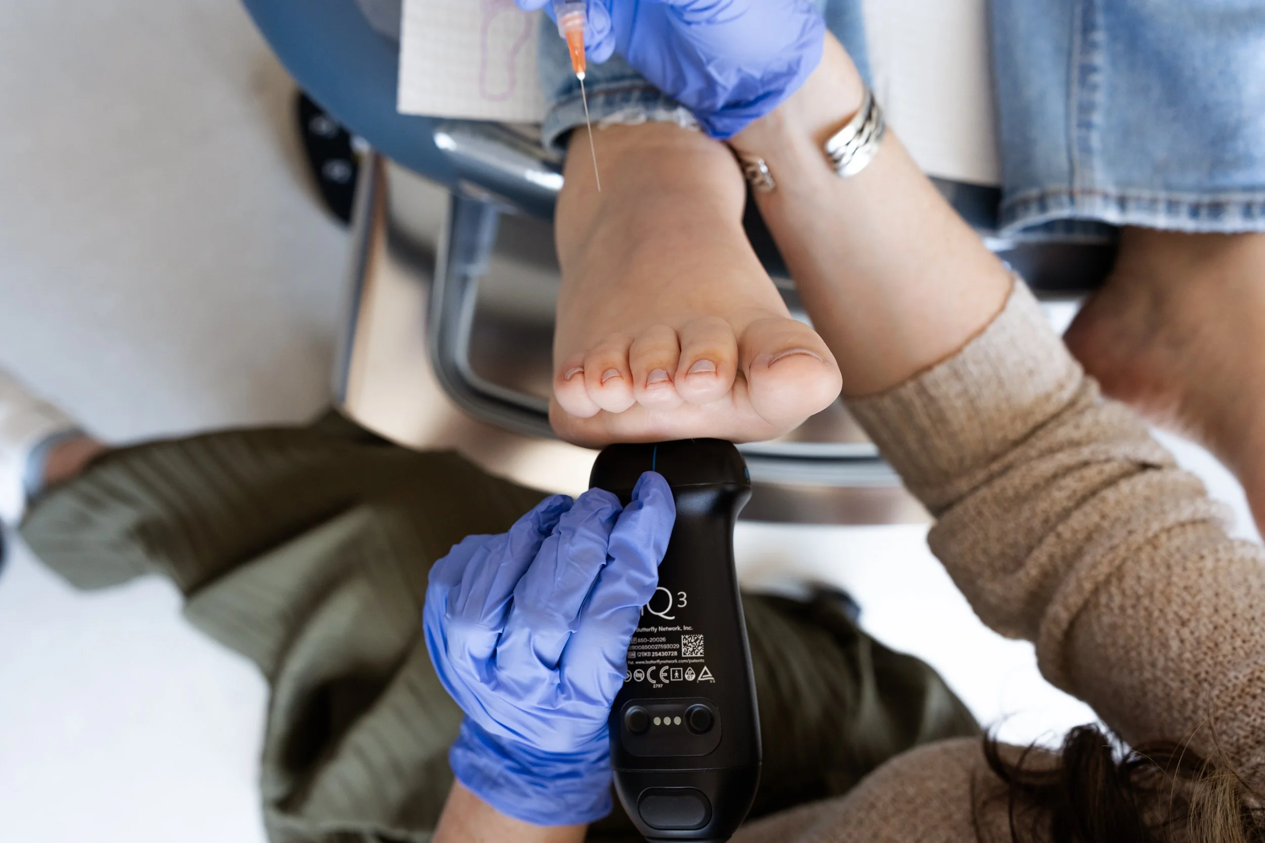LipoSana Injections for Foot Pain