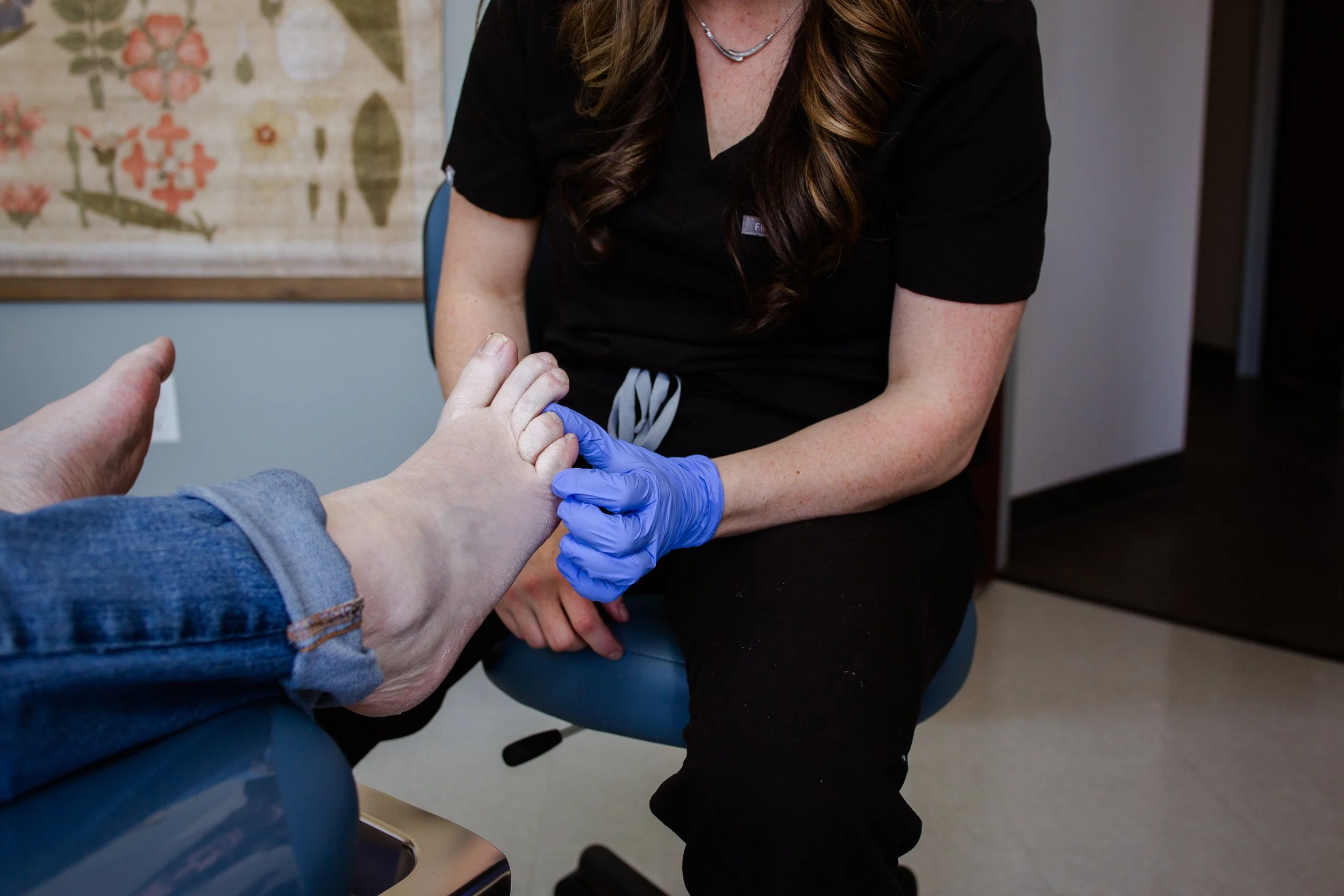 hammertoes treatment
