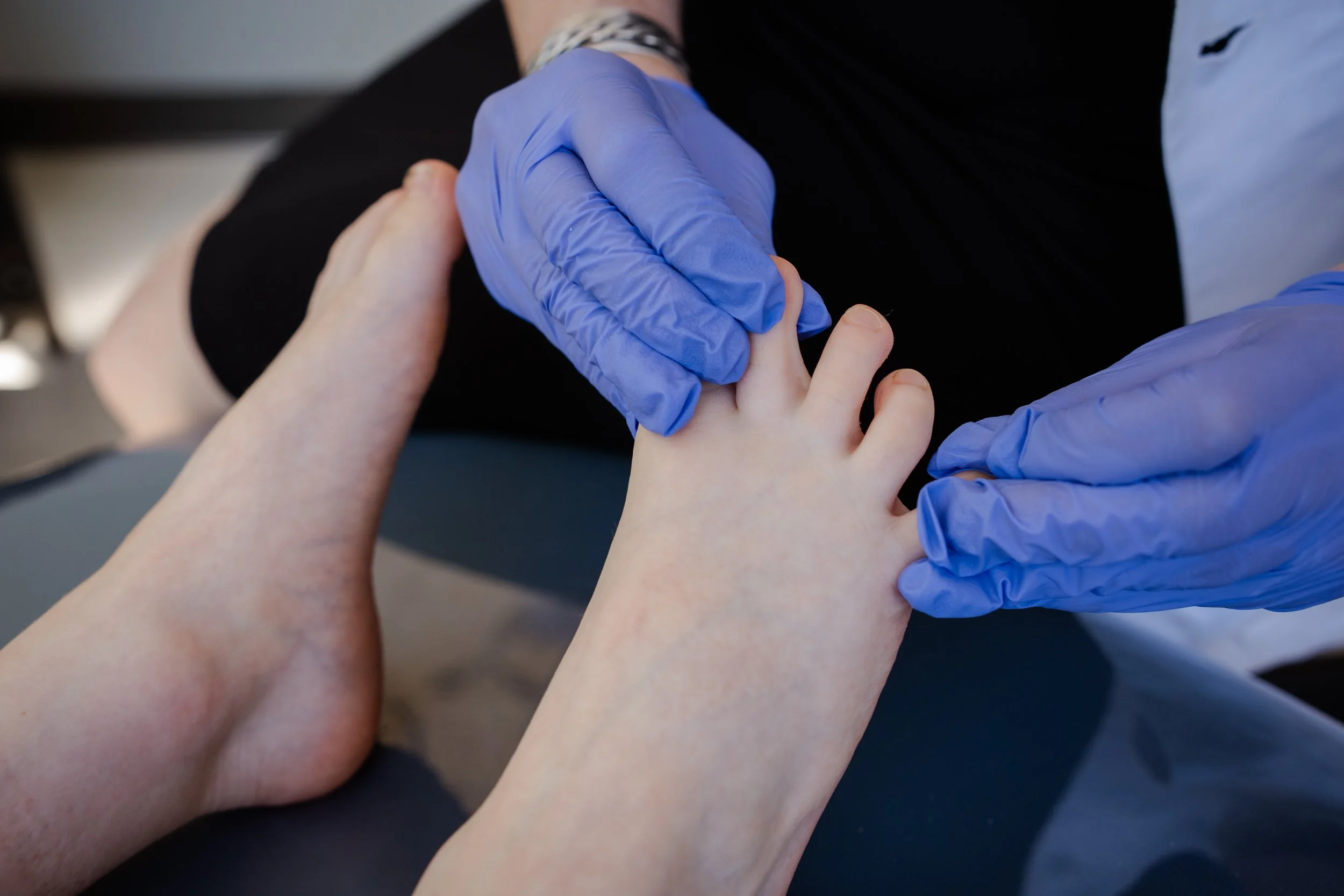 Athlete’s Foot