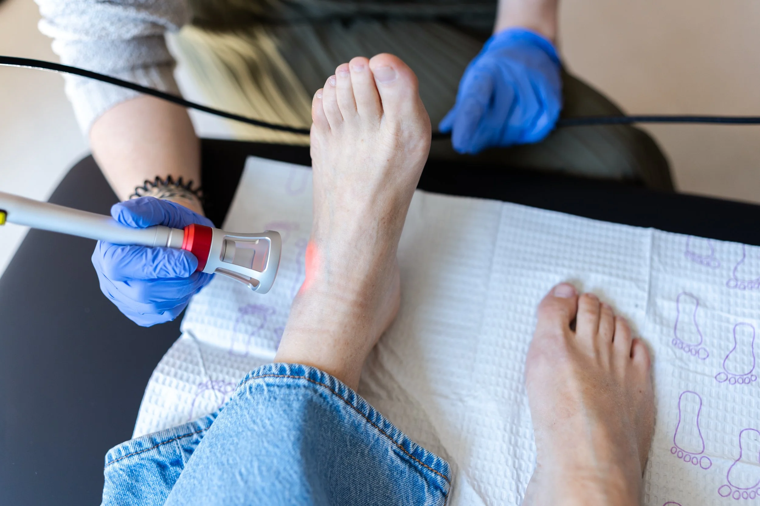 laser therapy for feet and ankles