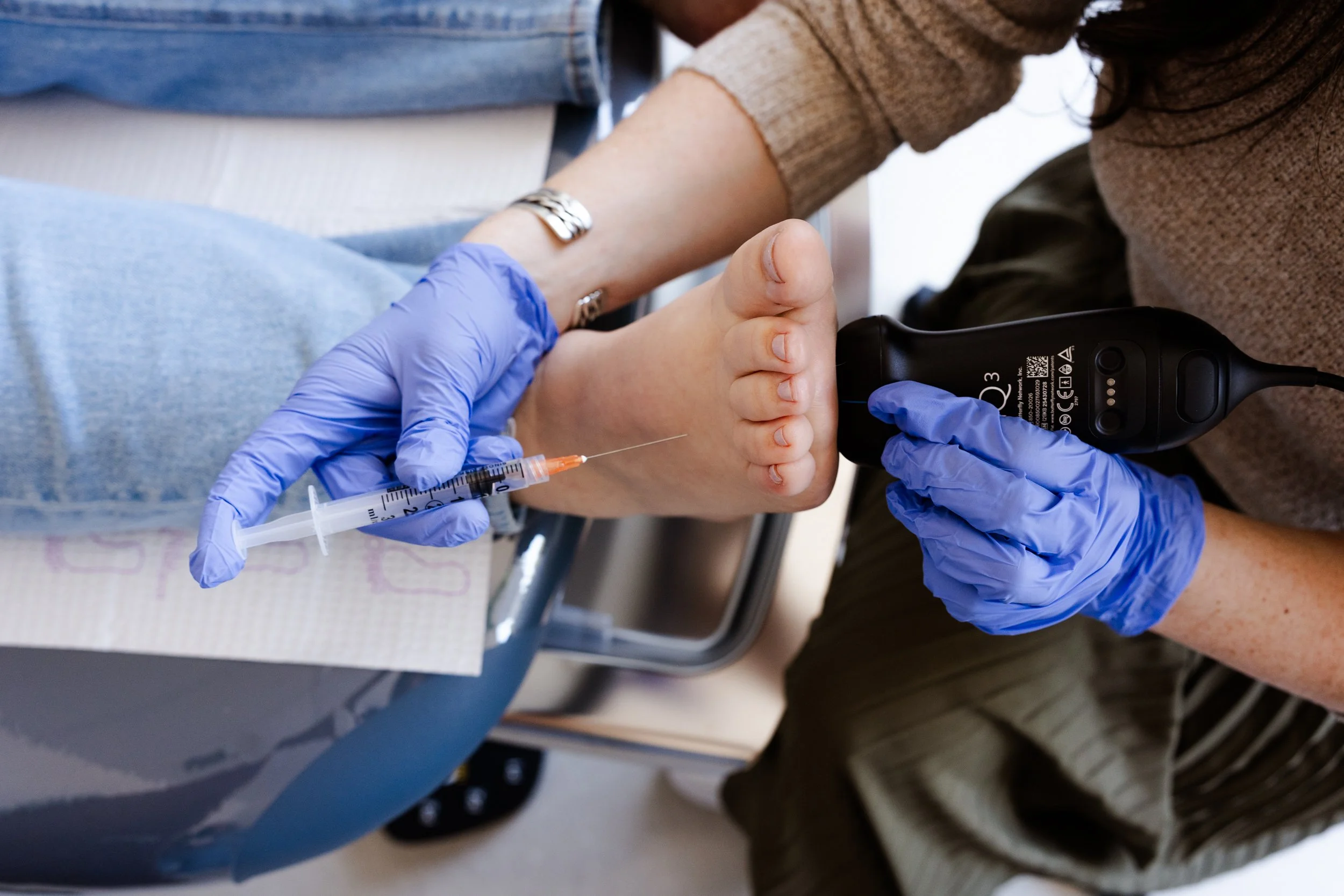 neuroma treatment injections