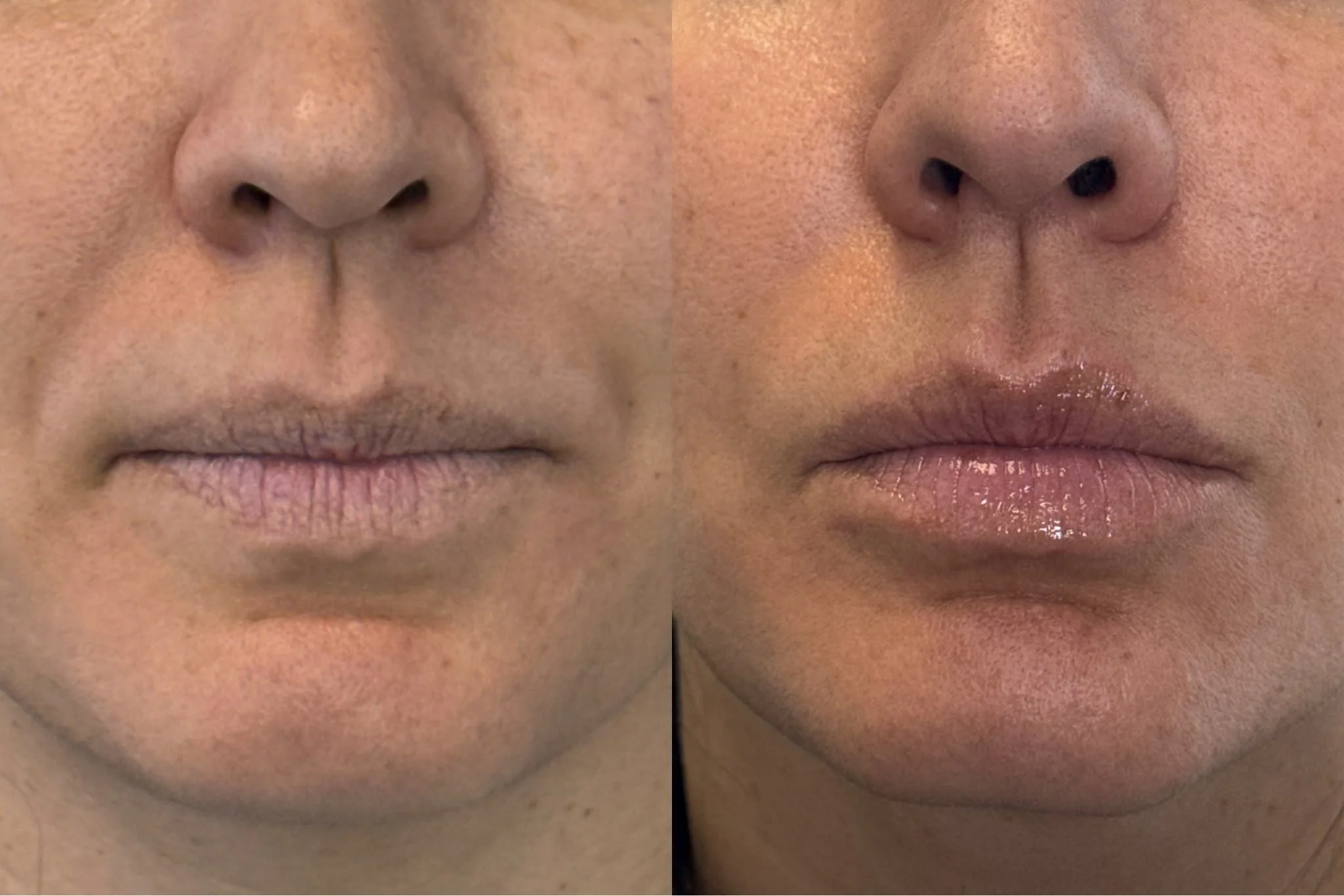 Close-up comparison of two human lips and noses, showing slight differences in skin texture and lip moisture.