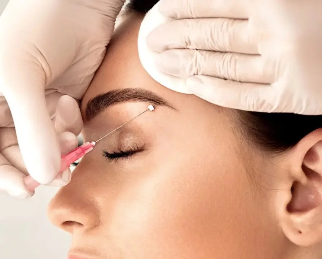 PDO Brow Lift