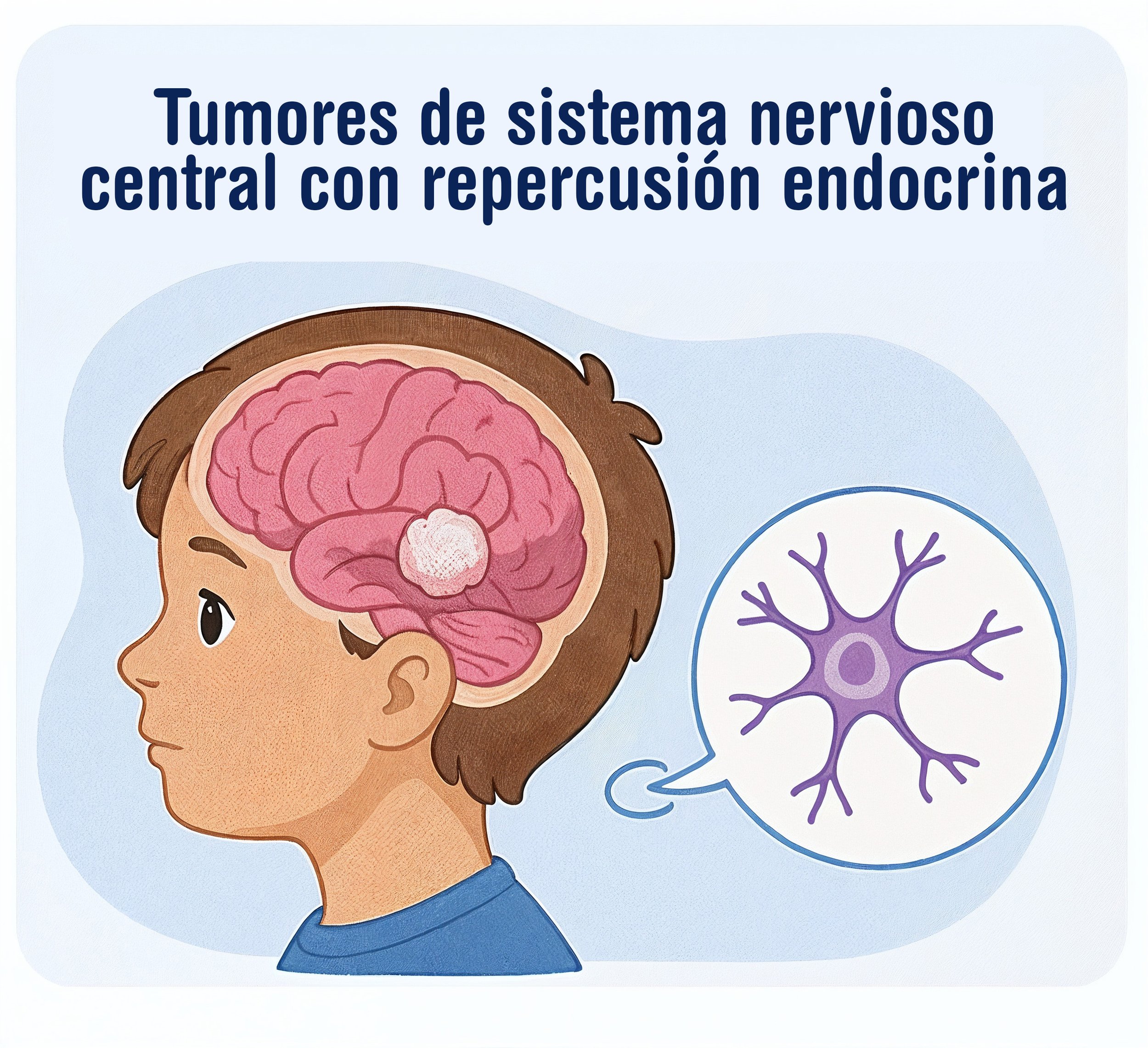 Ilustración infantil de un niño con un esquema del cerebro, representando tumores del sistema nervioso central que afectan el sistema endocrino  - Dra. Massiel Segura de Román