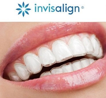 Invisalign and Clear Correct Aligners
