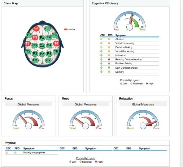 qEEG brain map report at Jamieson Health Center