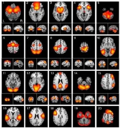 Improving functional brain networks at Jamieson Health Center