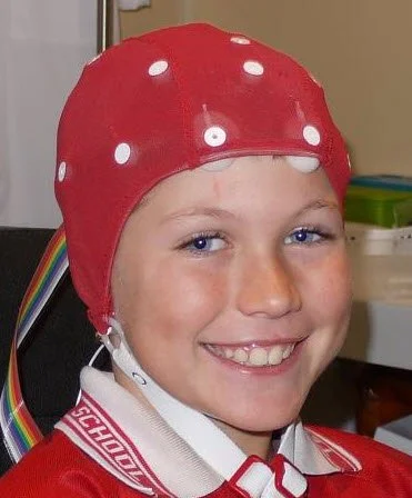 qEEG brain mapping at Jamieson Health Center