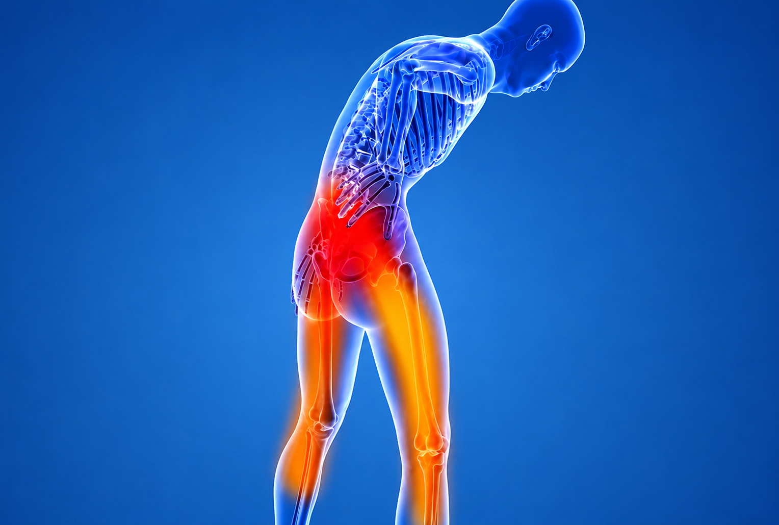 Lumbar disc herniation