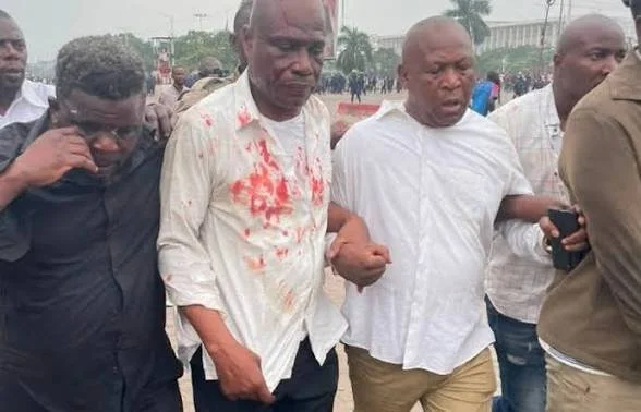 Kinshasa : quand un “sit-in” tourne à l’affrontement et brouille le récit politique
