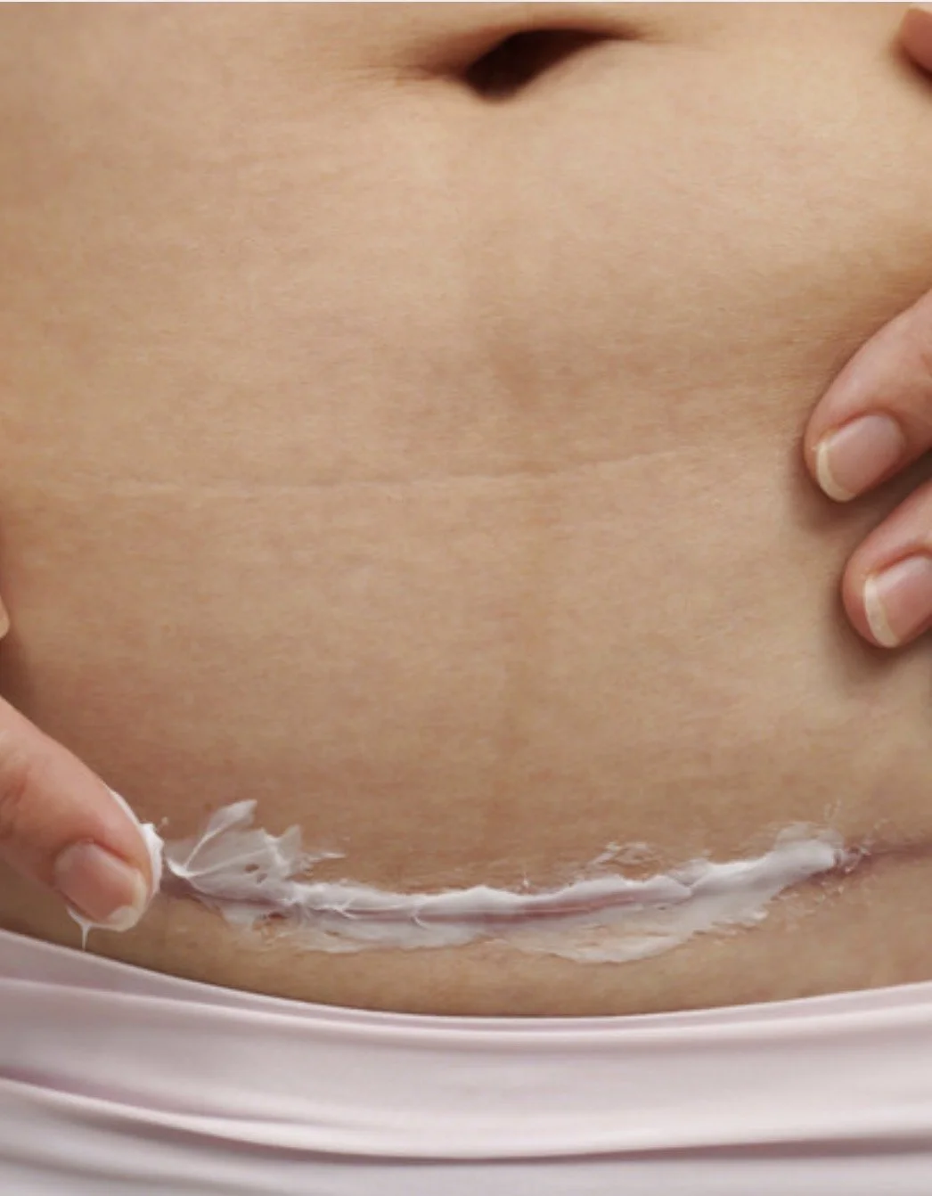 Close-up of a person applying or removing white cream or lotion on their abdominal area.
