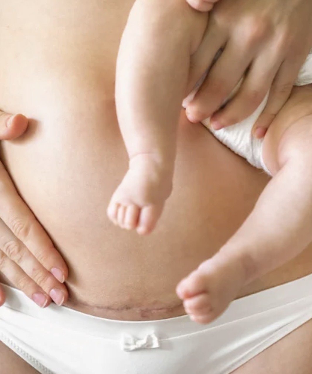 Close-up of a person holding a newborn baby's leg and belly, with the other hand resting on their abdomen, wearing white clothing.