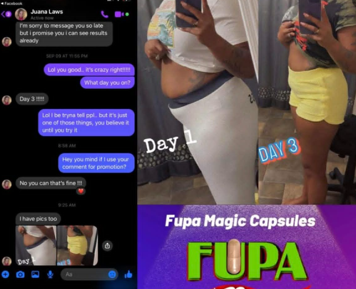 Side-by-side photos showing a woman’s midsection, with the left image labeled 'Day 1' and the right image labeled 'Day 3,' alongside a screenshot of a text conversation about using Fupa Magic Capsules for weight loss.