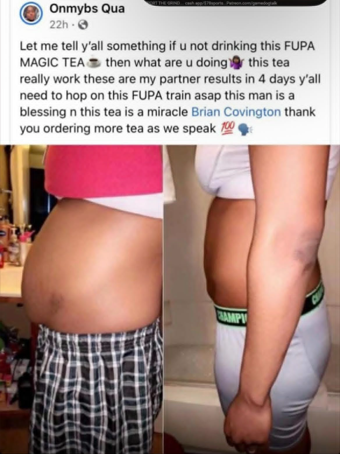Side-by-side comparison of a person's abdomen before and after using FUPA magic tea, showing reduced belly size and a flatter stomach.