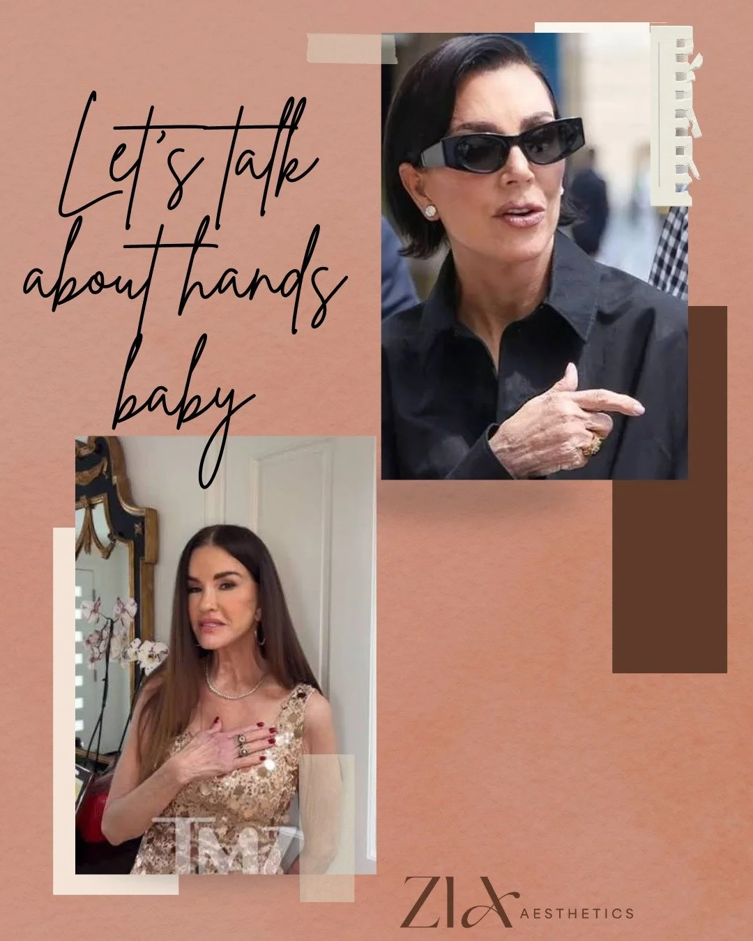Let's talk about hands, baby! 👋 Your hands can reveal your age even when your face doesn&rsquo;t. Protect them with sunscreen, especially if you're often driving. Adding microneedling to your skincare routine can help regenerate collagen and improve