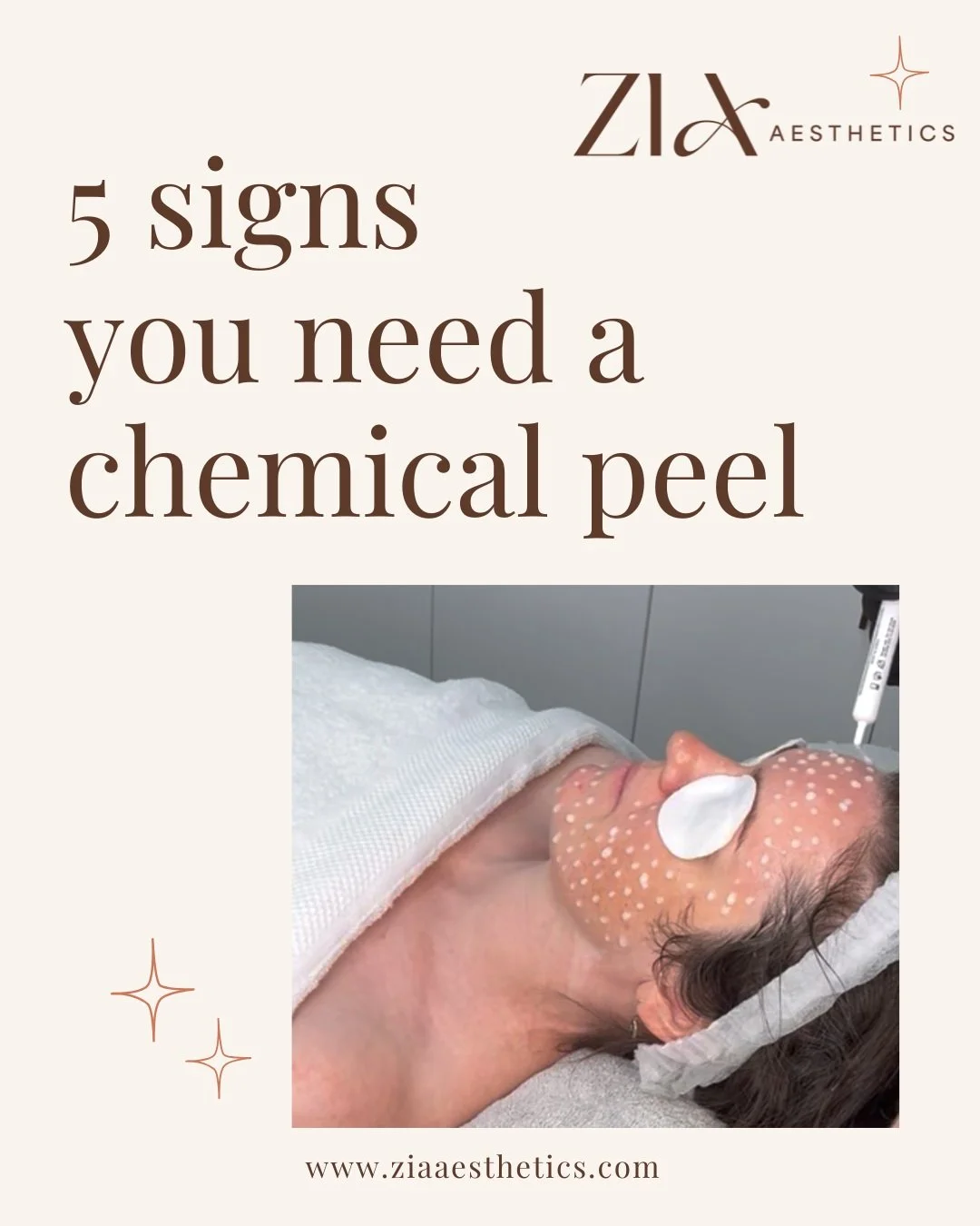 Chemical peels sound scary&hellip; but they really don&rsquo;t have to be. 🤍

Chemical peels have been used for years to refresh, resurface and reset the skin helping to improve the appearance of things like dullness, dryness, uneven texture, pigmen